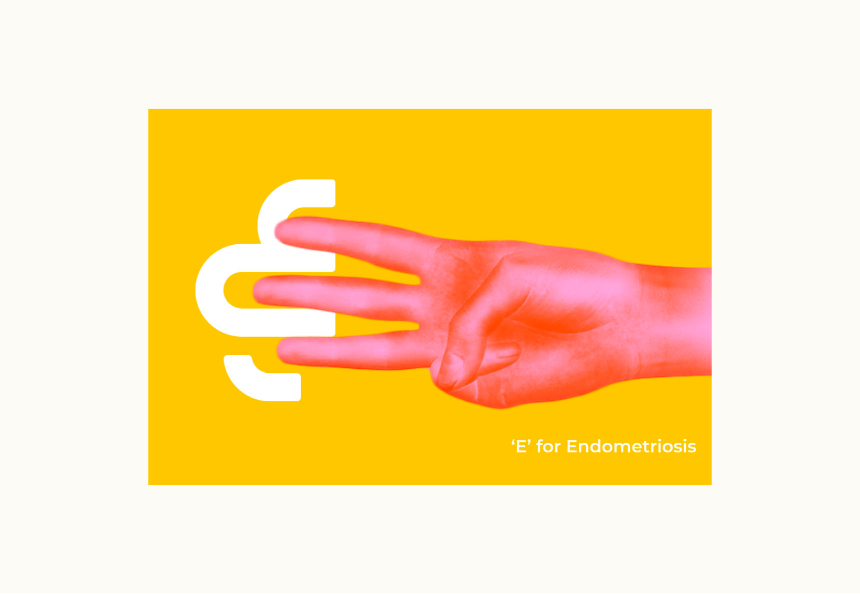 E for Endometriosis Logo
